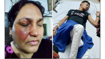 ফেঞ্চুগঞ্জে প্রবাসী ছাত্রশিবির নেতার স্ত্রীর উপর এসিড নিক্ষেপ
