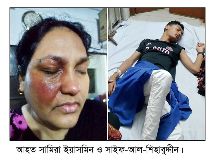 ফেঞ্চুগঞ্জে প্রবাসী ছাত্রশিবির নেতার স্ত্রীর উপর এসিড নিক্ষেপ