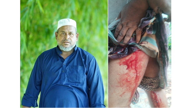 জকিগঞ্জে পৌর আওয়ামীলীগ নেতা তাজ উদ্দিনের বাড়ীতে হামলা : পিতা ও চাচাকে মারধর এবং গুরুতর জখম